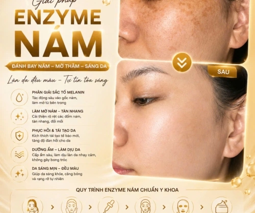 NÁM KHÔNG BIẾN MẤT SAU 1 ĐÊM... NHƯNG CÓ THỂ MỜ DẦN SAU LIỆU TRÌNH ENZYME NÁM