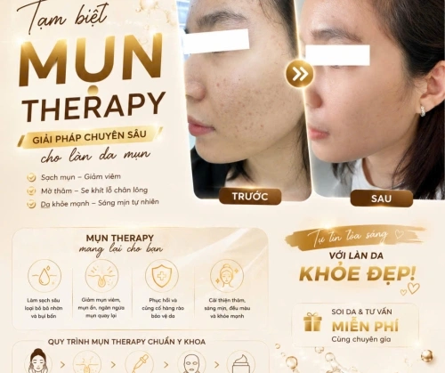 MỤN KHÔNG BIẾN MẤT SAU MỘT ĐÊM