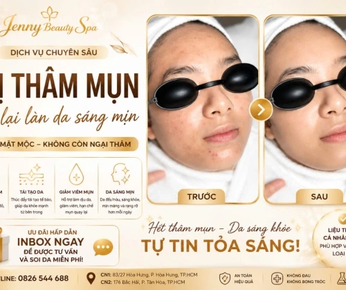 FLASH SALE 7 NGÀY – ĐIỀU TRỊ THÂM MỤN ƯU ĐÃI SIÊU HOT!
