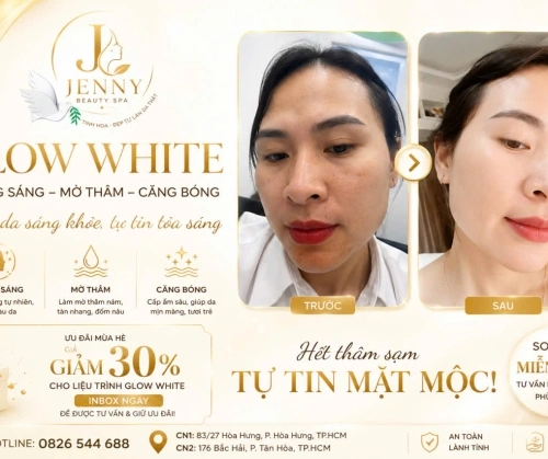  FLASH SALE GLOW WHITE – TRẮNG SÁNG RẠNG NGỜ, GIẢM THÂM TỰ TIN!