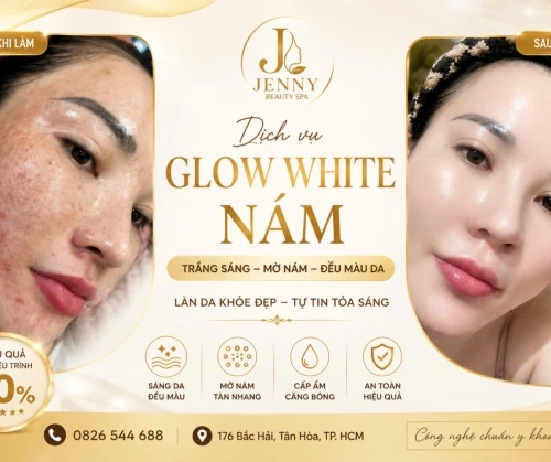 CHƯƠNG TRÌNH HOT THÁNG NÀY – GLOW WHITE NÁM GIẢM ĐẾN 30%