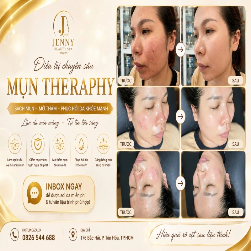MỤN KHÔNG CHỈ LÀ VẤN ĐỀ THẨM MỸ – MÀ CÒN LÀ SỰ TỰ TIN! 
