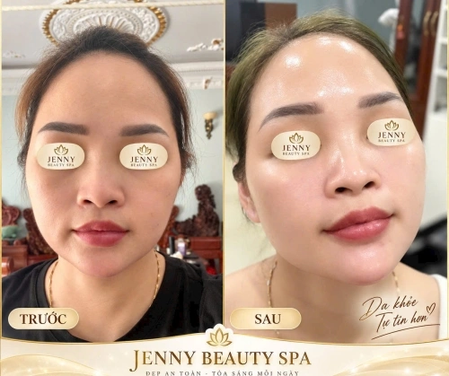 GLOW WHITE – CĂNG BÓNG, RẠNG RỠ