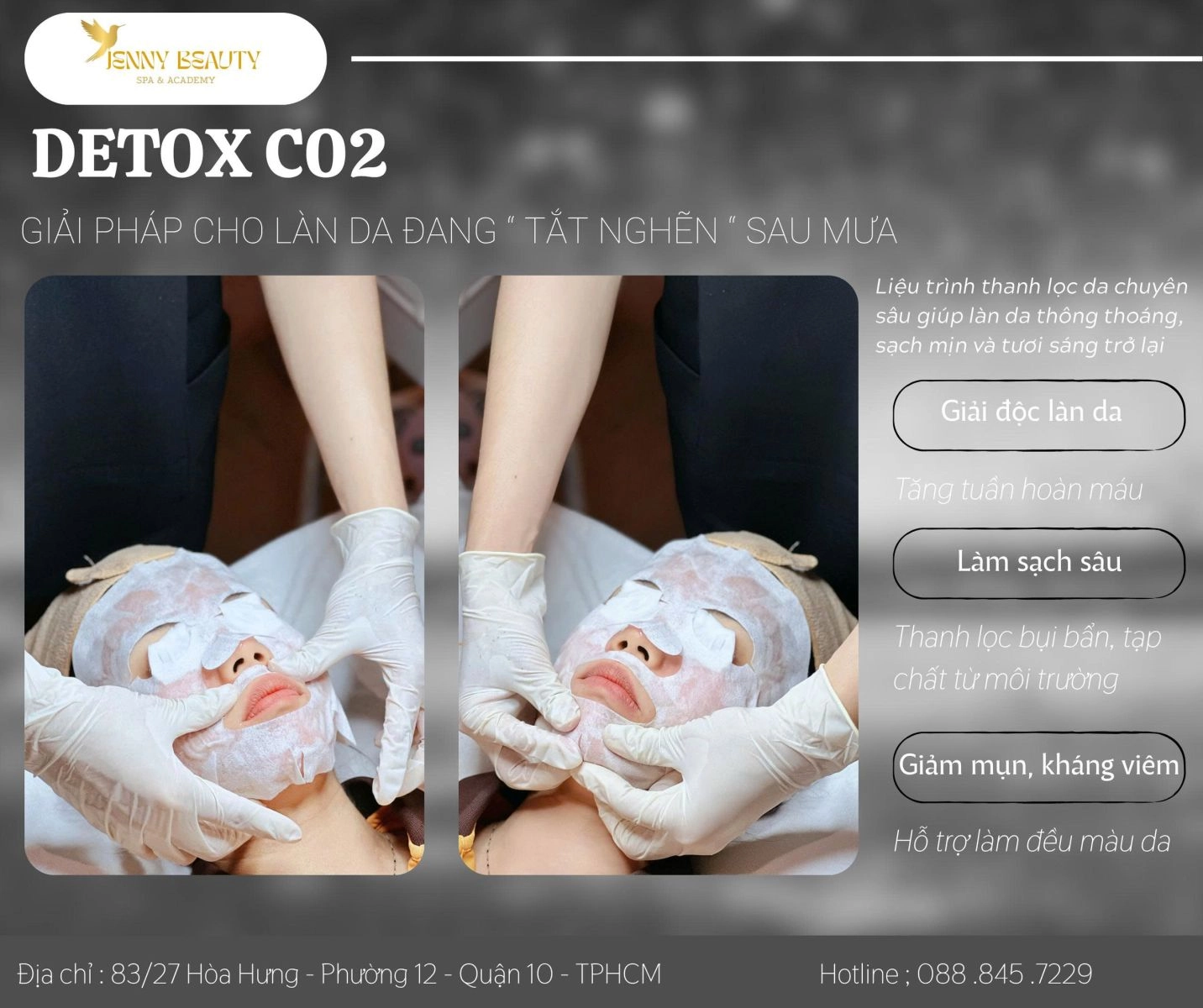 Kết quả điều trị mụn bằng công nghệ Mụn Detox CO2 tại Jenny Beauty.