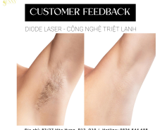 ? FEEDBACK KHÁCH HÀNG SAU KHI TRIỆT LÔNG ?