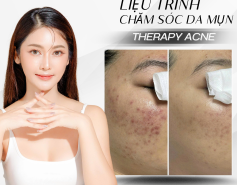 ?‍♀️ CHĂM SÓC DA MỤN – THERAPY ACNE ?