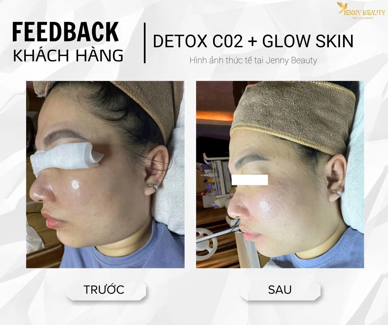  Không gian sang trọng và thư giãn tại spa Quận 10 uy tín Jenny Beauty.