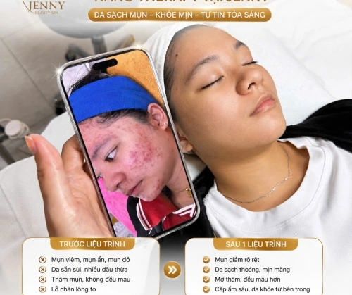 NANO THERAPY – CHĂM SÓC DA, HỖ TRỢ DA THOÁNG MỊN