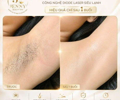 CÔNG NGHỆ BĂNG TUYẾT – ÊM DỊU, MÁT DA TẠI JENNY BEAUTY SPA