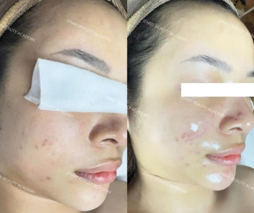 PEEL DETOX CĂNG BÓNG