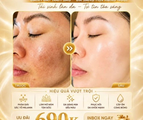 MẶT MỘC MÀ DA VẪN ĐẸP