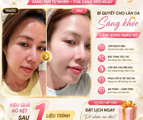 GLOW WHITE – ĐÁNH THỨC LÀN DA RẠNG RỠ CHỈ SAU 1 LIỆU TRÌNH
