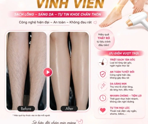 LÔNG CHÂN RẬM RẠP NHƯ 