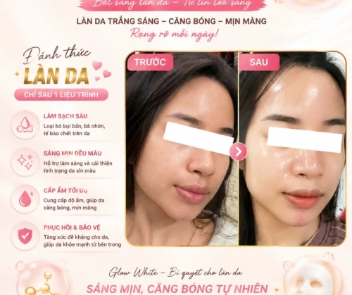 DA XỈN MÀ KHÔNG CẦN FILTER? BÍ MẬT NẰM Ở GLOW WHITE