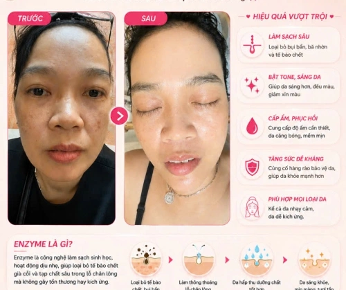 DA ĐẸP KHÔNG TỰ NHIÊN MÀ CÓ – DA ĐẸP LÀ DO CHĂM