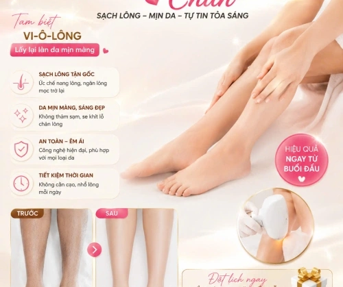 TRIỆT LÔNG CHÂN – NHẸ NHÀNG TẠM BIỆT 