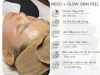 MESO x Glow Skin Peel – Bí quyết làn da căng bóng, lột xác