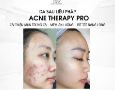 ​  ACNE THERAPY PRO – LIỆU TRÌNH CHĂM SÓC DA MỤN CÁ NHÂN HÓA  ​