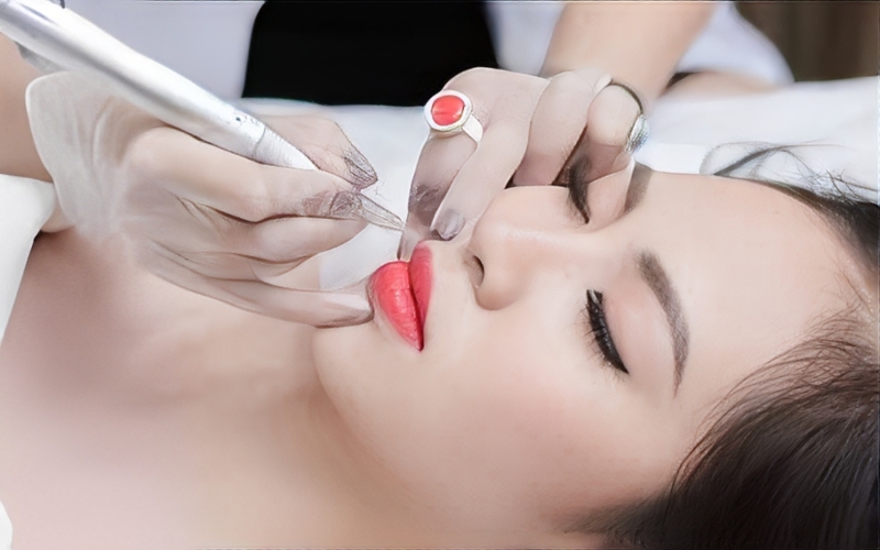 Kết quả điều trị mụn bền vững và phục hồi da tại Jenny Beauty.