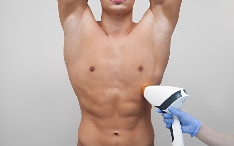 Tại Sao Nam Giới Nên Triệt Lông