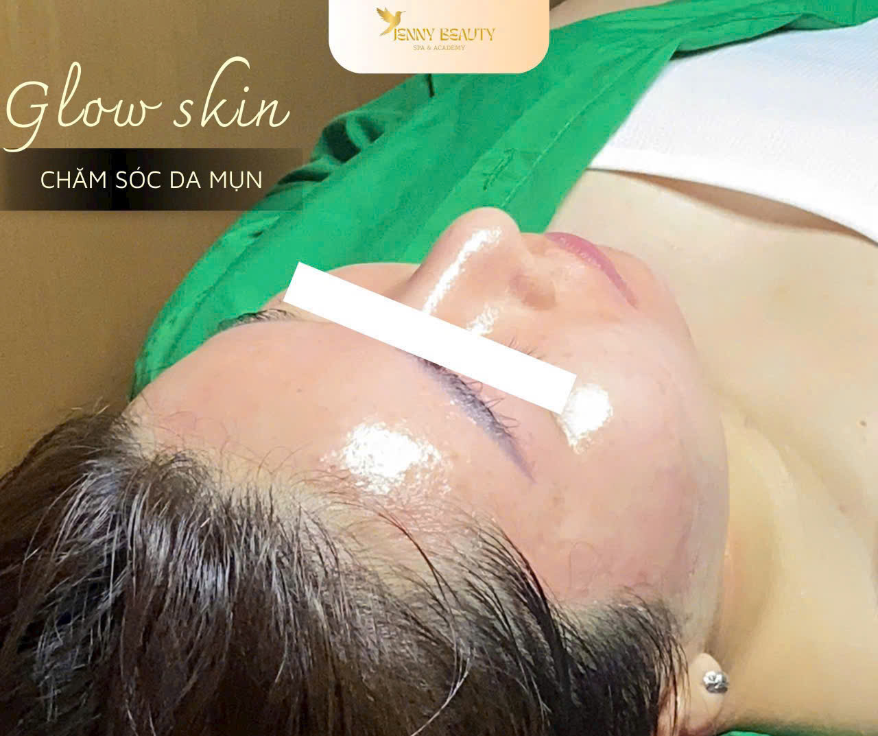 Làng da căng bóng sau khi sử dụng dịch vụ jenny beauty